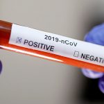 उपत्यकामा एकैदिन थपिए ५७२ कोरोना संक्रमित, ३ जनाको मृत्यु